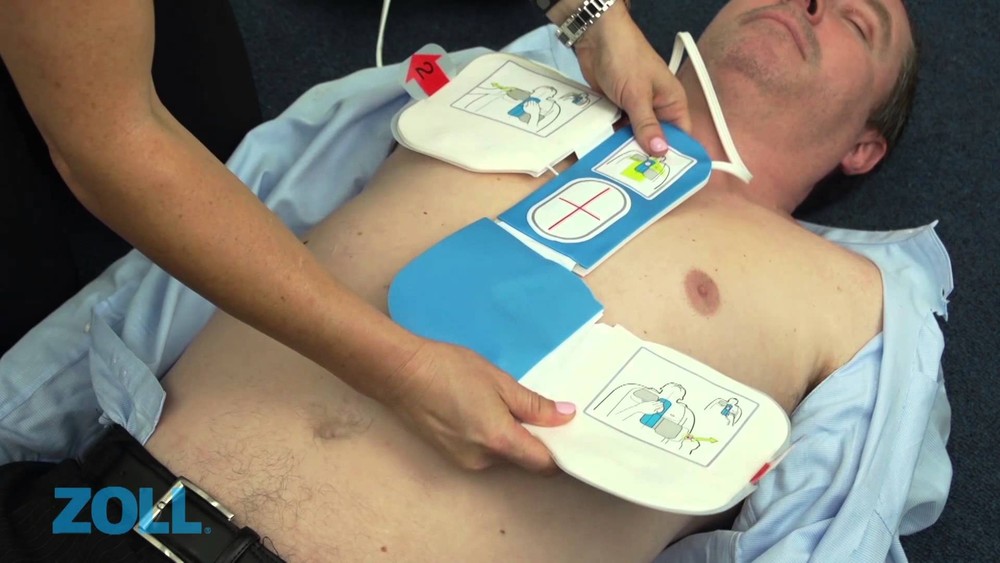 CPR-D-Padz Elektroden zu ZOLL AED Plus CPR